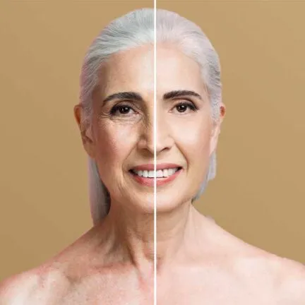 Plasma Pen Behandlung im Gesichtsbereich