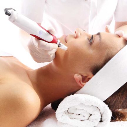 Microneedling Behandlung im Gesicht