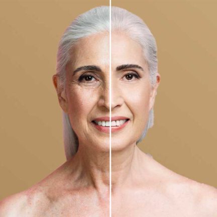 Plasma Pen Behandlung im Gesichtsbereich